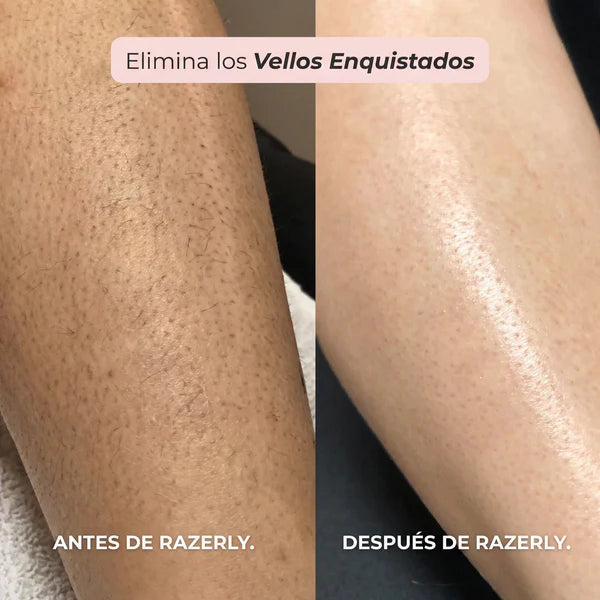 Depiladora Electrica Femenina 2 en 1 Razerly™- Doble Cabezal para Todo el Cuerpo