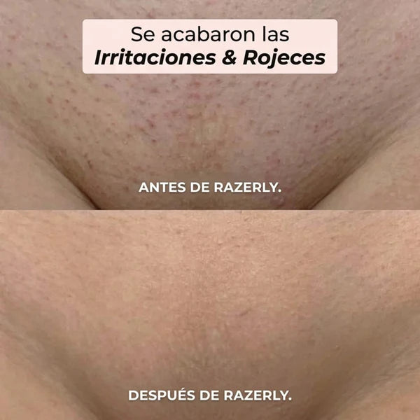 Depiladora Electrica Femenina 2 en 1 Razerly™- Doble Cabezal para Todo el Cuerpo